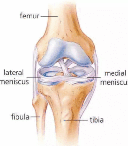 Meniscus Tear